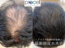 ラポノンプラス(La ponon+)