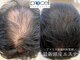 ラポノンプラス(La ponon+)の写真