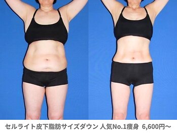 アンシャンテ 神戸元町店(Enchante)/痩身ダイエット　神戸元町三ノ宮