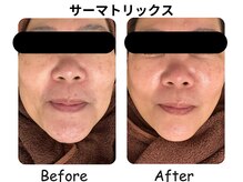 ラディアント たまプラーザの雰囲気（芸能人御用達マシン【サーマトリックス】で小顔くせ付け＆キープ）