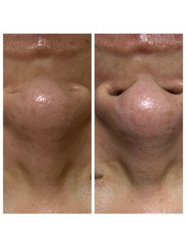 ルシアル(LUCIALL)/