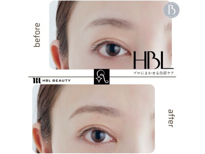 リンネ(Rinne)の写真