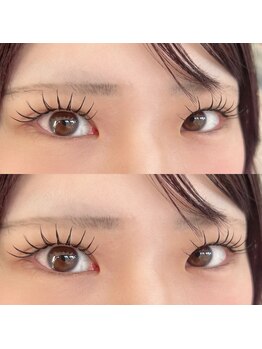 ブロッサ(Blossa)/アンドヘルシー80束