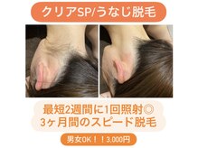 ディサイドロー(DECIDE L.A.W)/BeforeAfter