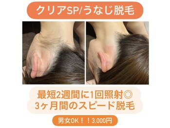 ディサイドロー(DECIDE L.A.W)/BeforeAfter