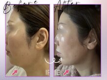 アイリー(IRIE)の雰囲気（小顔、たるみ管理はアイリーへお任せ下さい。）