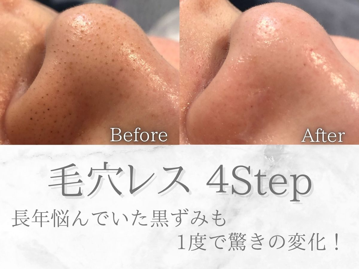 ネオファースト(NeoFirst)｜ホットペッパービューティー