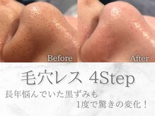 ネオファースト(NeoFirst)