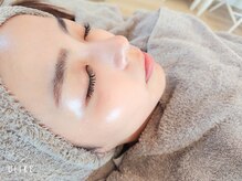 クラリス(Clarice)/エンビロン/施術後のお写真