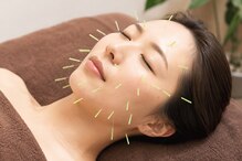サンキュー鍼灸院整体院