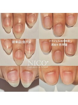 ニコプラス(NICO+)/自爪育成中