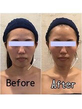 小顔フェイスラボ 瀬田店(小顔 Face Labo.)/小顔＆整体コルギの変化