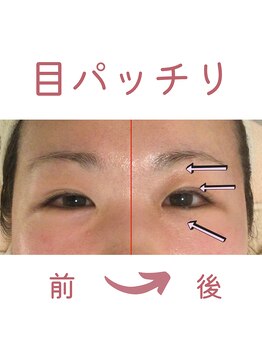 シーフェイス(see face)/本来の目の大きさ取り戻す