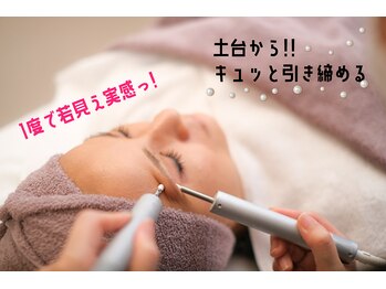 グレースカロン(grace kalon)