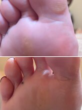 フス(FUSS)/foot&bodycare FUSS