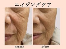 ウィズマツオカ 菊池本店/エイジング効果写真