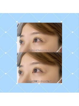 メメル 大阪梅田 中津店(memelu)/根本からしっかり立ち上げ♪