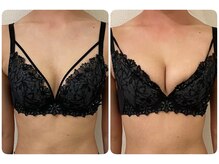 モナンジュ(ramonange)/初体験のお客様　before after