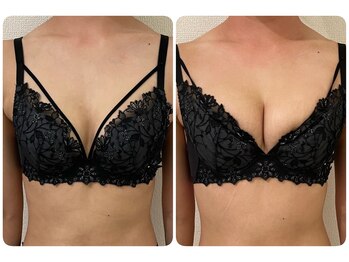 モナンジュ(ramonange)/初体験のお客様　before after