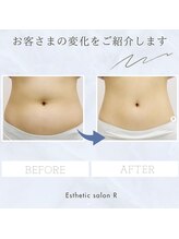 エステティックサロンR/