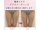 デイスパ ヴィータの写真/【ヒップ、太もも、ふくらはぎ】コンプレックスの塊の下半身を変える！私の脚でも細くなれるんだ！驚き！