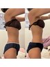 【選べるリポベラ導入】本気ダイエット腕/お腹/脚/二の腕から1部位