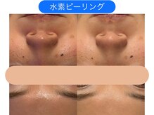 クレヴィア バイ サイバーエステ(CREBIA)/【トーンアップ/透明感】