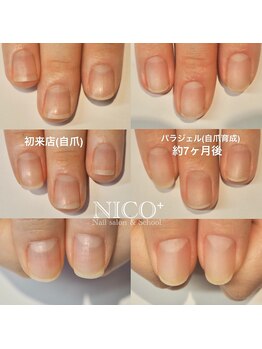 ニコプラス(NICO+)/自爪育成中