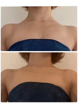 エムプリュ 心斎橋店(M.plus)/食事指導で肩スッキリ★