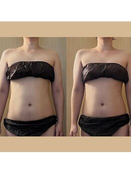 ココア(CoCoa)/活性リンパ洗浄