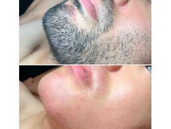 エピシアドットエヌ(epicia.N)/頬ずりしたくなる肌に