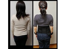 美容整体ナチュラル(natural)の雰囲気（ダイエットなしでこの効果！）