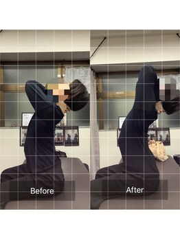 ナオル整体 中野院(NAORU整体)/施術実績