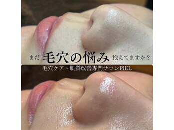 ピエル 北千住店(PIEL)/まだ毛穴の悩み抱えてますか?