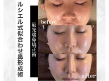 ルシエルの雰囲気（【最先端小顔術】ダウンタイムなしに自然に美しさを引き出す）