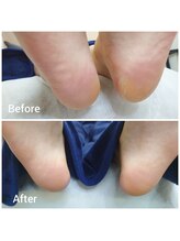 リゼラアンドコー 矢板店/