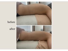 アンドスロウ(&slow)/お客様の変化　ゆるかっさ