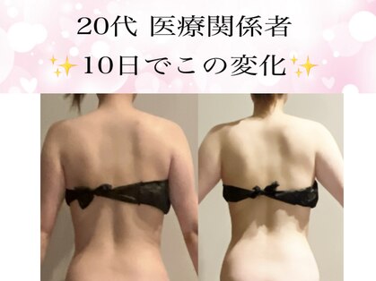ヨサパーク ボヌール 門司駅店(YOSA PARK bonheur)の写真