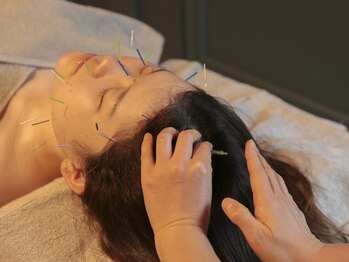 サリエ(S'allier)の写真/国家資格者在籍◇【美容鍼×エステ】で一人一人の美と健康をサポート◎お悩みに合わせた手法で改善へ。