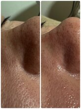 エクラ 長崎(ECLAT)/メンズOK