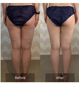 トリムリターン 三重伊賀店Mana/冷え足の疲れ根本解消で楽に