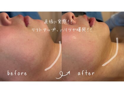 サロン リノ(salon rino)の写真