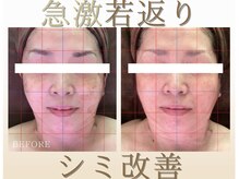 小顔矯正プロの雰囲気(一度の施術で【即実感】スッキリ爽快♪仕事のパフォーマンスUP☆)