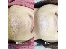 サロン シェリミー(Cheri mi)/男性美肌ヒゲ脱毛