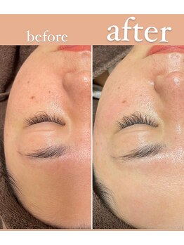 グランデ(GRANDE)/フェイシャルワックス