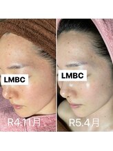 ルーチェエムベルシック(Luce.MBelChic)/エクスビアンスピーリング