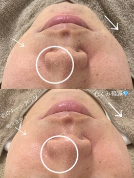 ニコ(25)/ラミピール