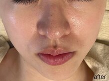 サロン ド エメ(salon de aimer)/【After】潤いアップ！艶！