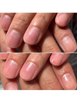 エピシアドットエヌ(epicia.N)/メンズ美容は爪先から