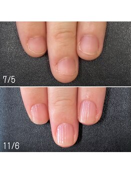 ネイルズ アヴァンティ(Nails Avanti)/自爪育成ネイルケア